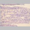 Intestino Delgado 14.jpg